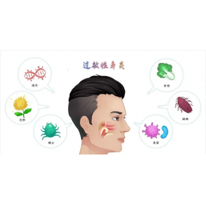銘仁耳鼻喉專家分享：如何一招解決過敏性鼻炎的打噴嚏流鼻涕！