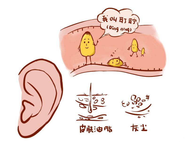 耳朵里有耳屎要不要掏？耳屎多，到底該咋辦？(圖2)