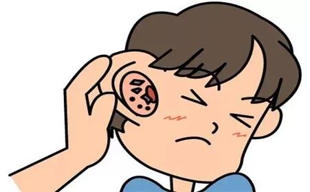 耳朵頻繁發(fā)癢，可能是這4種病的表現(xiàn)，快看看是啥(圖2)