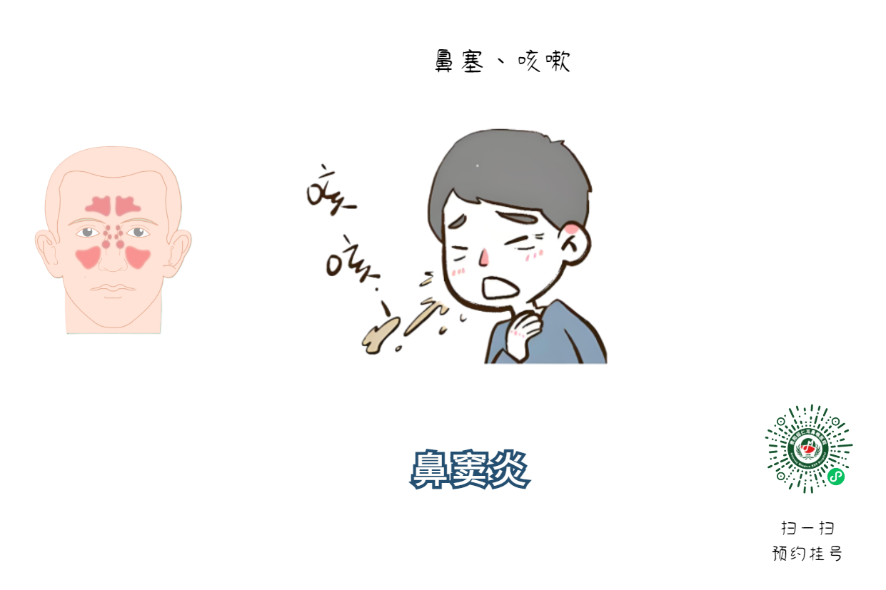 孩子鼻塞、流涕、頭疼可能不是感冒，而是鼻竇炎，家長需警惕！(圖1)