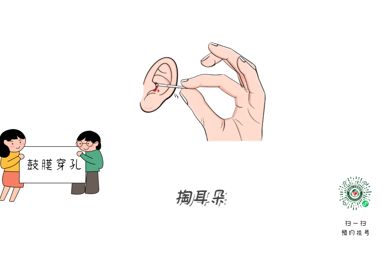 掏耳朵致鼓膜穿孔？這些動作最危險！(圖1)