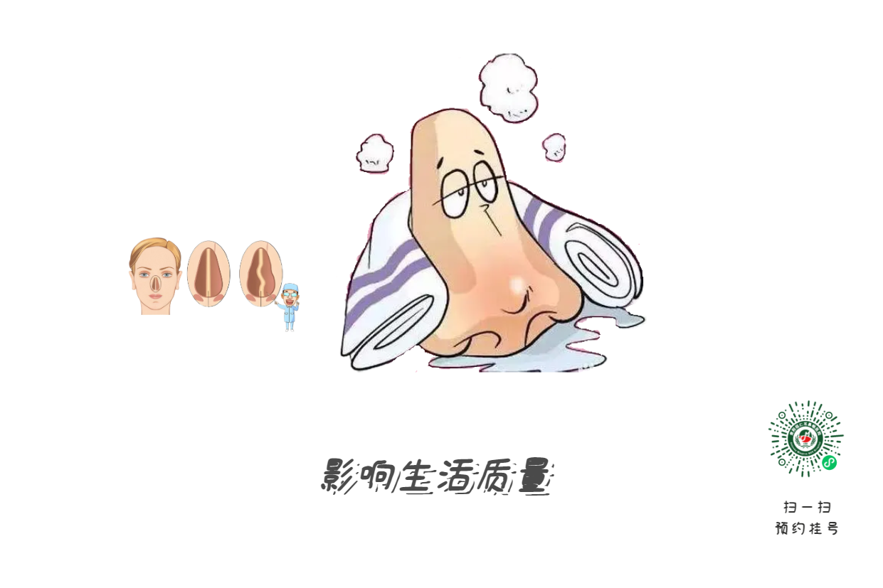 十年鼻塞不見(jiàn)好？問(wèn)題可能出在“鼻梁歪了”！(圖3)