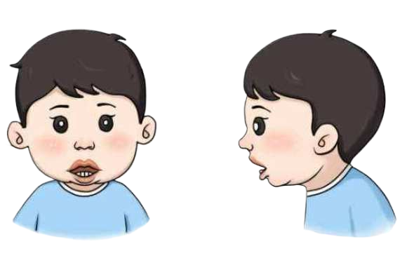 腺樣體影響智力？研究結(jié)果嚇壞家長(圖2)